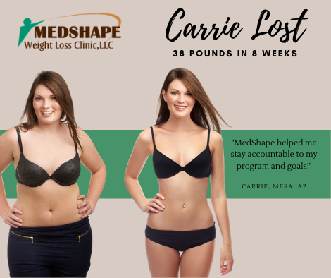 Before and after: Carrie lost 38 pounds in 8 weeks at MedShape in Mesa, AZ