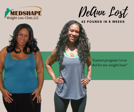 Before and after: DeAnn lost 42 pounds in 8 weeks with MedShape