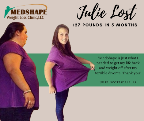 Before and after: Julie lost 127 pounds in 5 months at MedShape in Scottsdale, AZ
