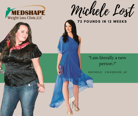 Before and after: Michele lost 72 pounds in 12 weeks with MedShape in Chandler, AZ